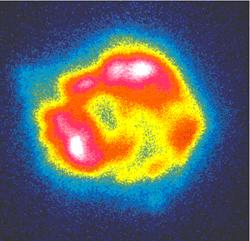 Cassiopeia A (ROSAT showed bubbles)